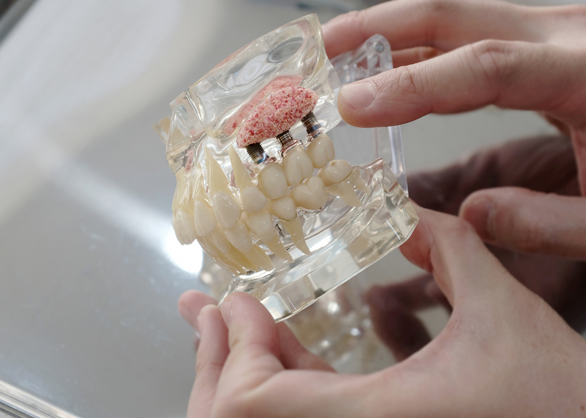 Factors leading to jawbone deterioration