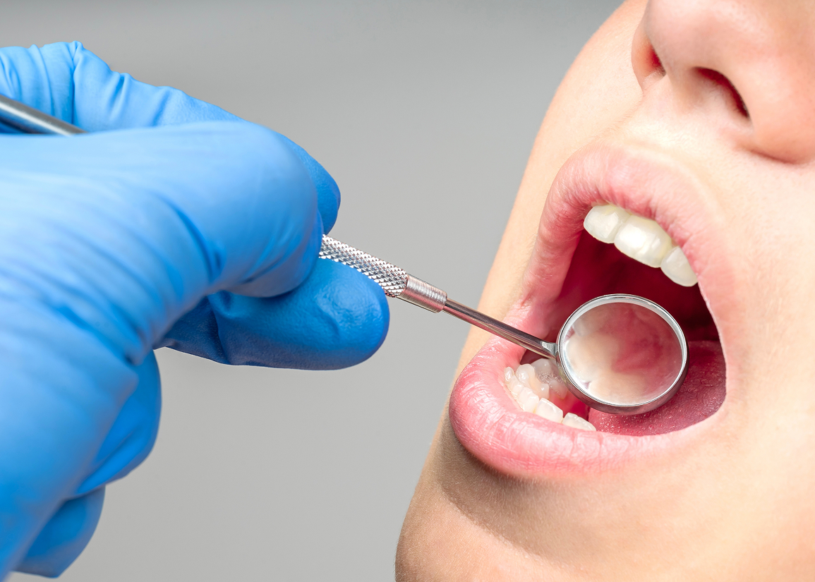 Personalized oral hygiene education