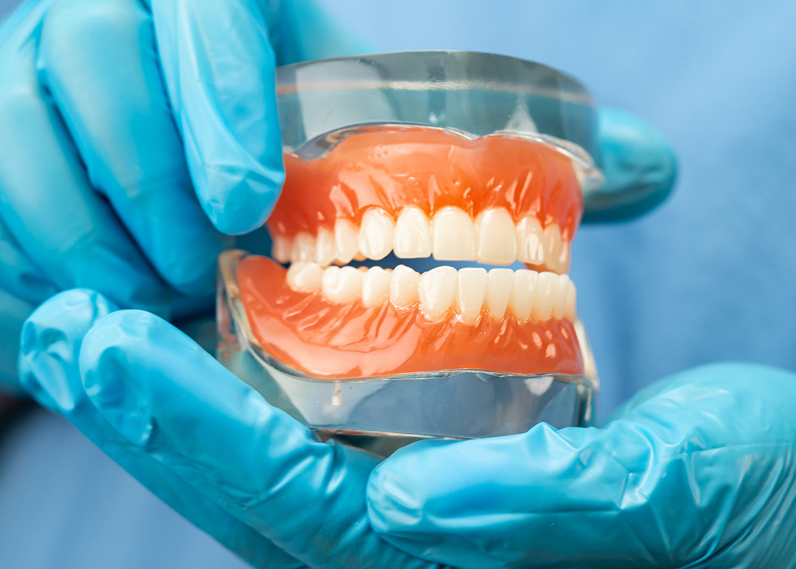 Dentures replacing missing teeth