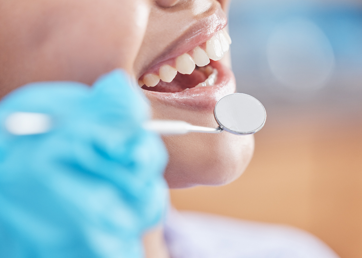 Fluoride protection for a healthy smile
