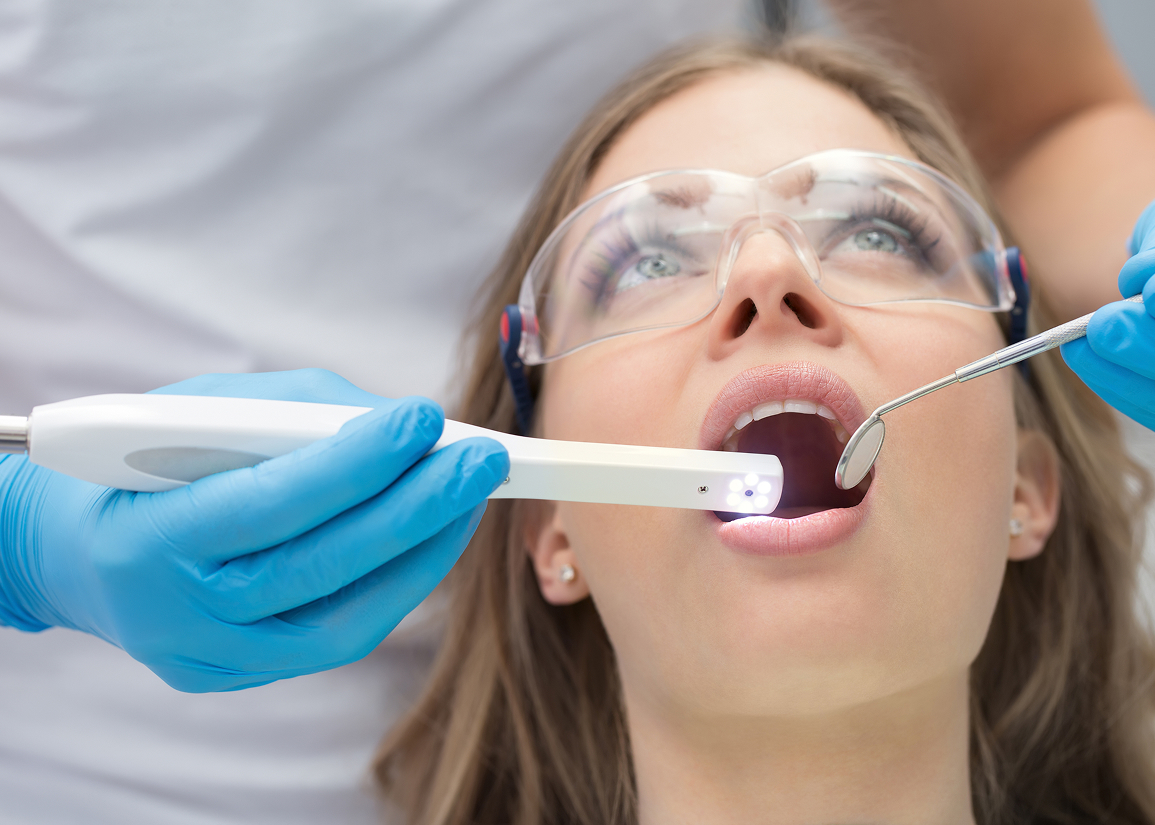 Intra-oral camera for dental imaging