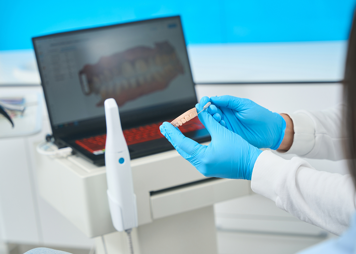 Intra-oral cameras for treatment planning