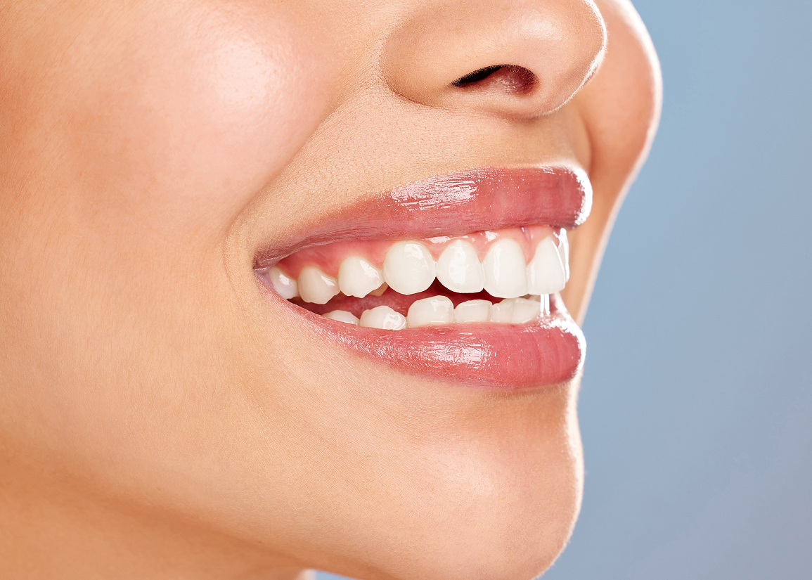 Nightguard protecting teeth during sleep