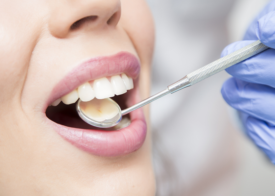 Healing after pinhole gum surgery