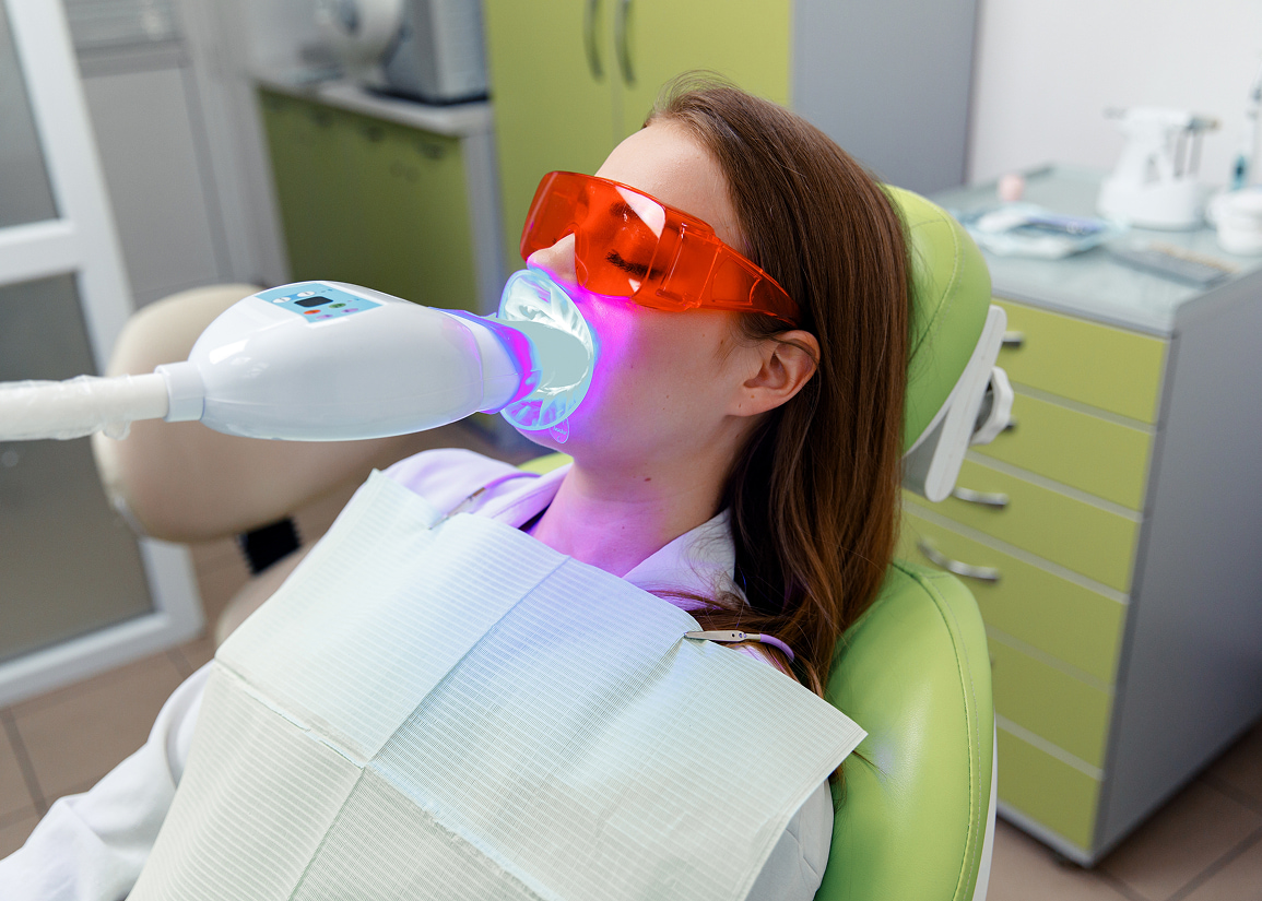 Professional teeth whitening benefits