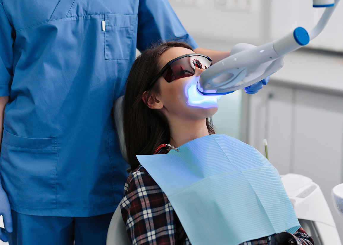 How to keep your smile white