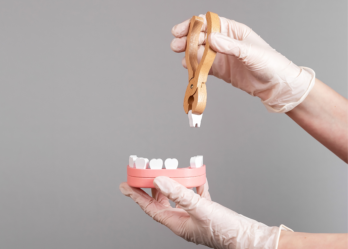Removing damaged or problematic teeth