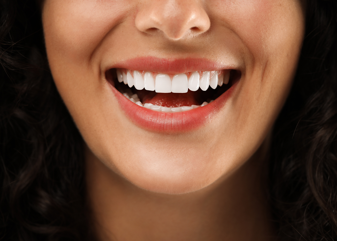 The dental veneer process